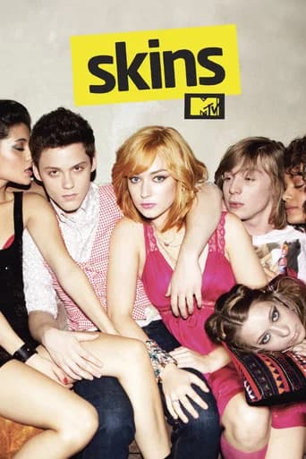 Skins UK